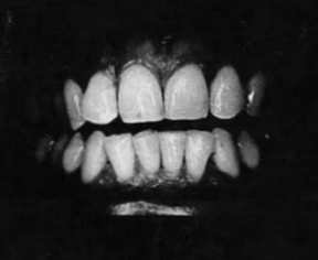 Mouth